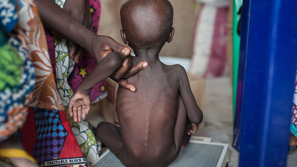 UNICEF: 1.3M Kids In Nigeria And Ethiopia Face Hunger Crisis