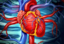 Cardiac Society Raises Alarm Over Soaring Cases of Hypertension in Nigeria
