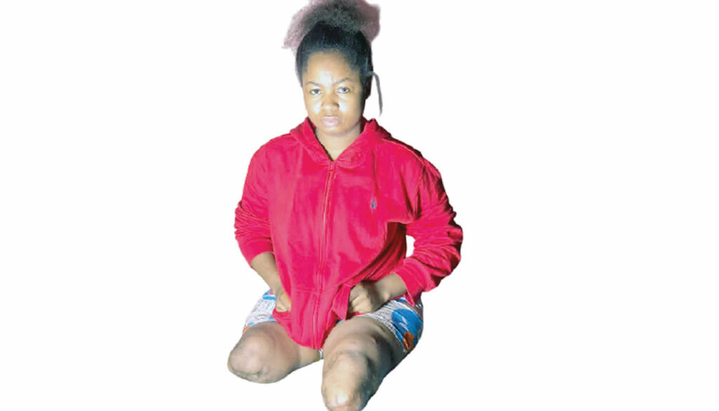 I Prayed to Die in My Sleep: A 23-Year-Old’s Fight for Life