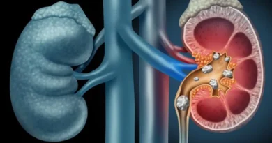 A Growing Global Health Threat: Chronic Kidney Disease